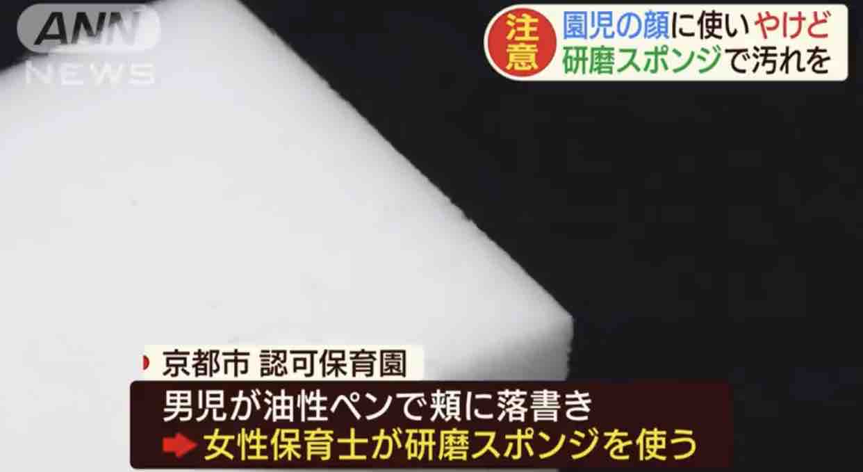 保育士がメラミンスポンジで顔こする ３歳男児やけど きままと