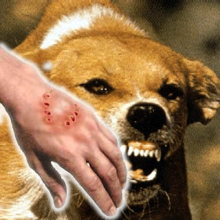 human_rabies