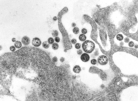 Lassa_virus