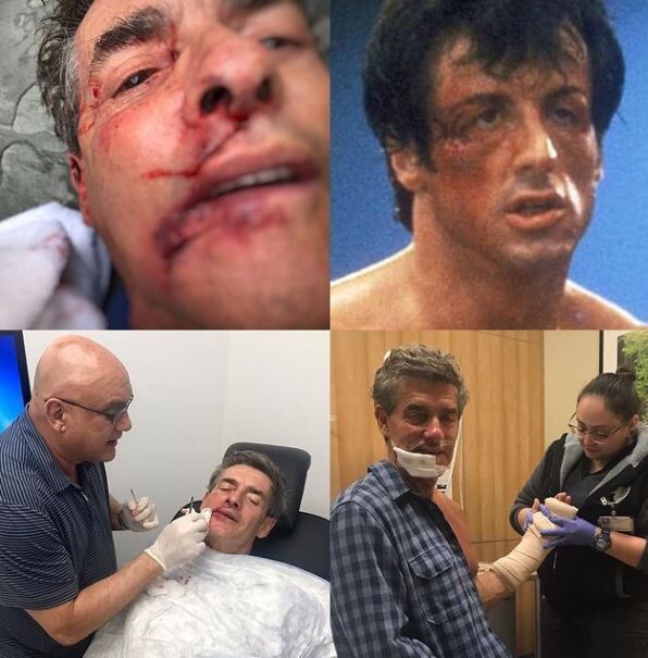 Dominique Sachse`s husband`s accident