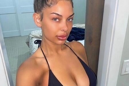 Aliza Jane Before surgery 2