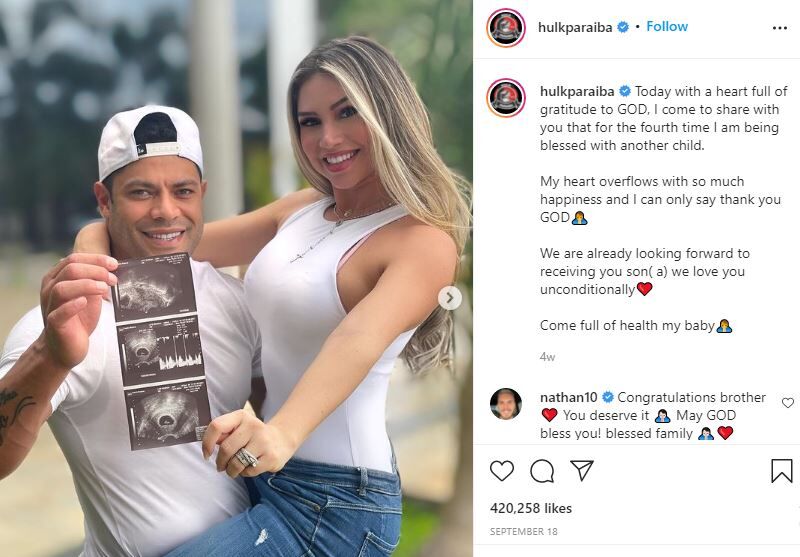 Iran Angelo`s ex-husband Hulk and his wife Camila Angelo expecting a baby