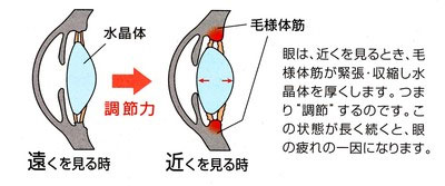 疲れ目1