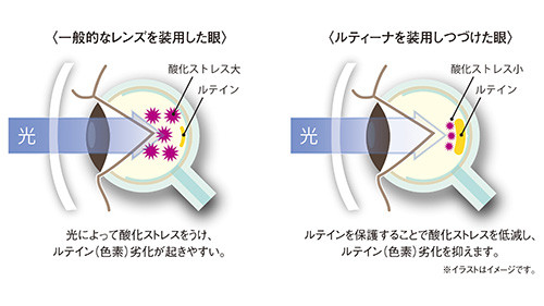 ルティーナ眼球企画図350