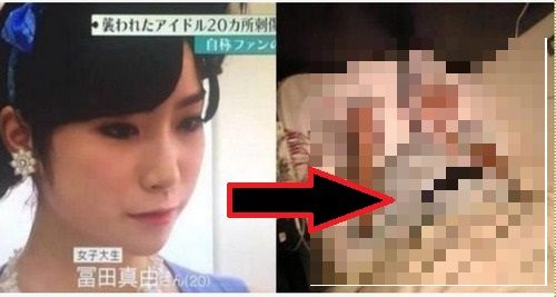 閲覧注意 34箇所刺されたアイドル 冨田真由さん の現在が 嘘だろ Specialstar 96のblog 閲覧注意 34箇所刺されたアイドル 冨田真由さん の現在が 嘘だろ Specialstar 96のblog