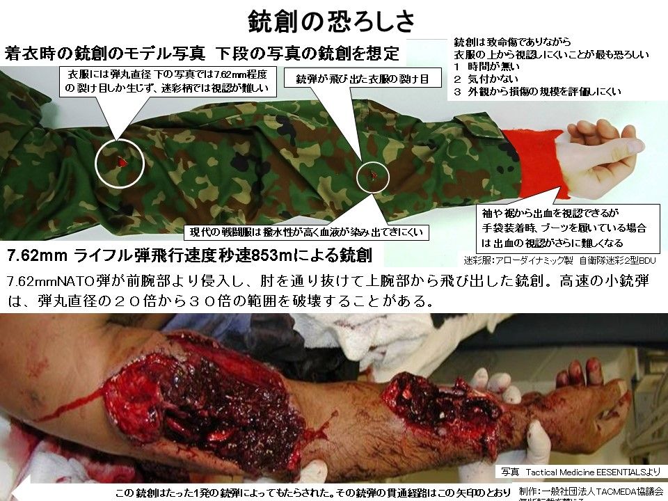 国会で陸自個人携行救急品の問題が取り上げられました Tacmedaブログ 有事医療を考える 国会で陸自個人携行救急品の問題が取り上げられました Tacmedaブログ 有事医療を考える