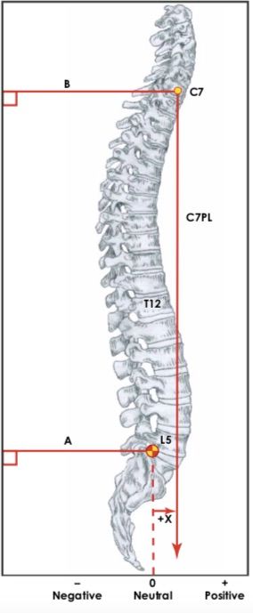 SDSG-radiographic-measuremnt-manual_pdf(75___120ページ)