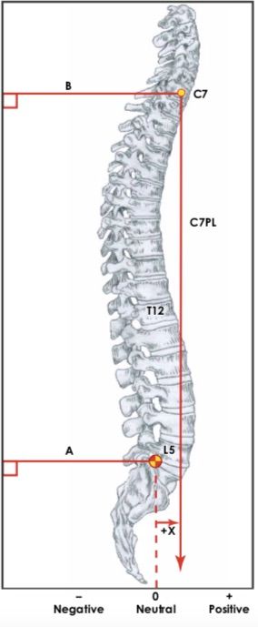 SDSG-radiographic-measuremnt-manual_pdf（75___120ページ）