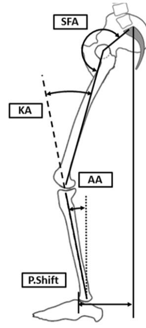 Spinal_deformityに関するreview_Neurosurg__pdf（3___16ページ）