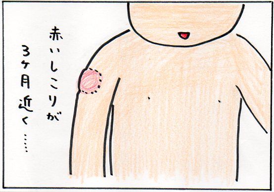 卵アレルギーと予防接種 Enjoy Parenting
