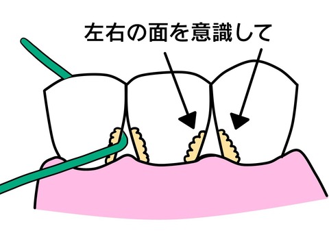 1389706コピー