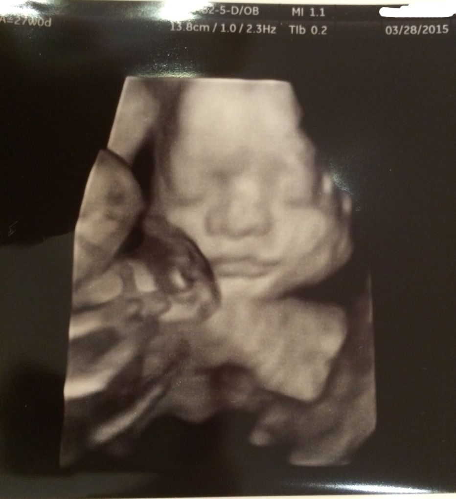 27w0d 妊婦健診 赤ちゃんの写真 性別ほぼ確定 続 私の赤ちゃん