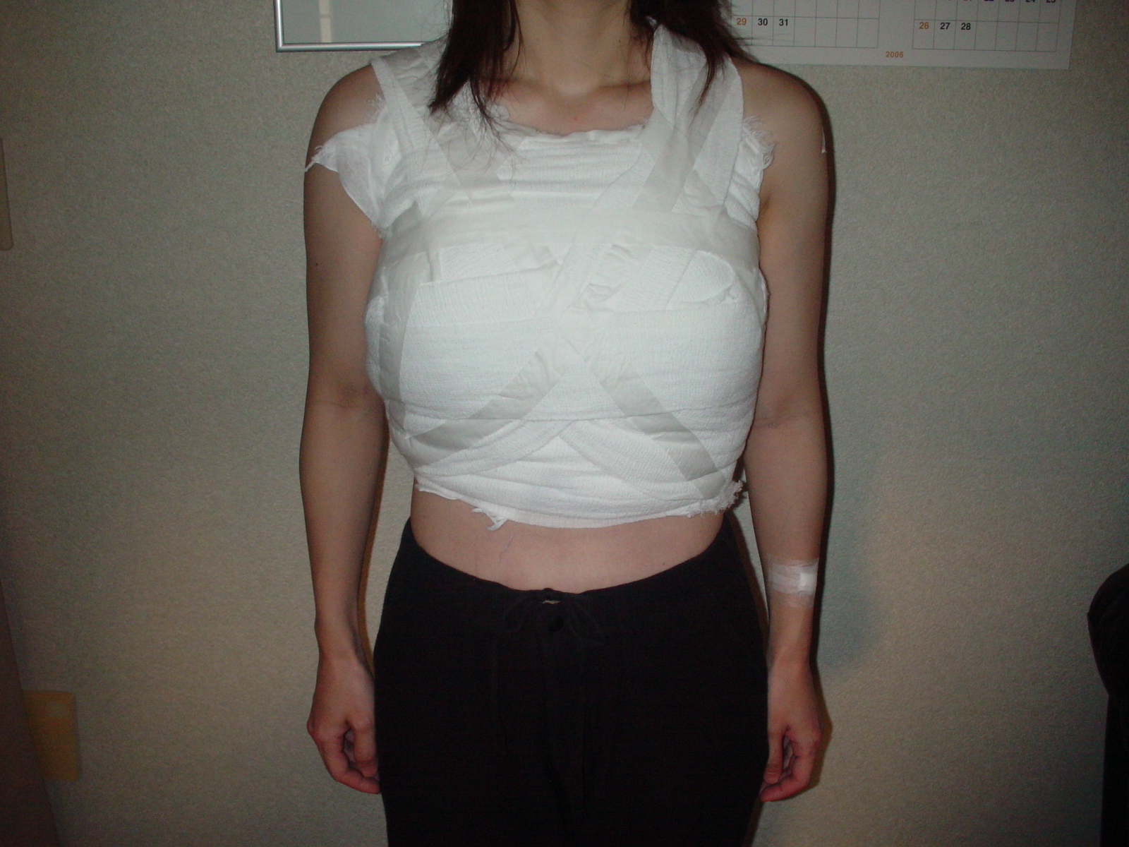 豊胸手術日記~綺麗なお姉さん目指して~豊胸手術2日目~5日目 livedoor Blog(ブログ) 豊胸手術日記~綺麗なお姉さん目指して~豊胸手術2日目~5日目 livedoor Blog(ブログ)