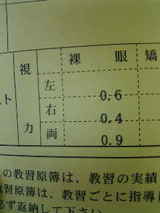 視力