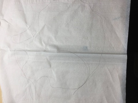 35465849-s