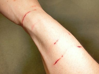 引っかかれた 史上最大級 Zakkan 引っかかれた 史上最大級 Zakkan
