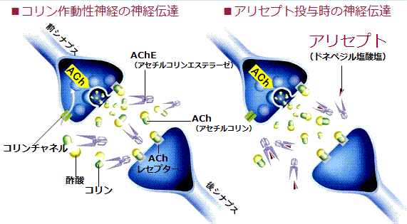 脳卒中にならないためのリハビリテーション薬は効かない⑥ コリンエステラーゼ阻害薬(ドネペジル、ガランタミン、リバスチグミン)服用で失神、除脈、大腿骨頚部骨折リスク増加 Arch Intern Med. 2009;169(9):867-873コメントするトラックバック