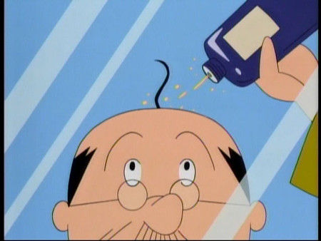 心臓リハビリテーション 生え際の後退 耳たぶのしわなど 老化は心疾患のサイン 脳卒中にならないためのリハビリテーション