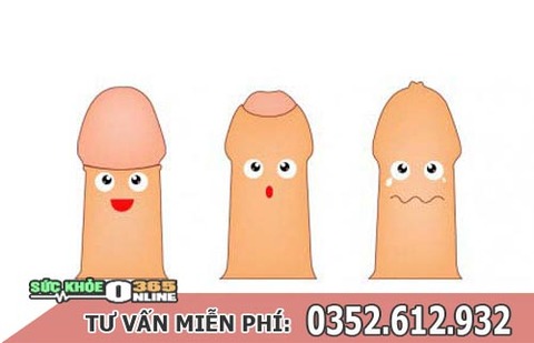 cat-bao-quy-dau-la-gi