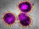 kolona_virus-getty