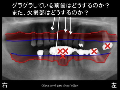 饤16