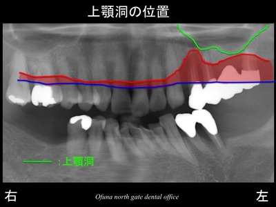 饤06