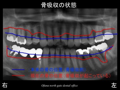 饤13