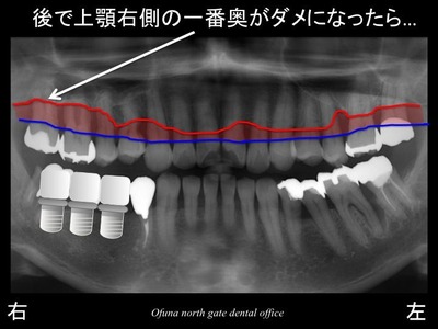 饤18