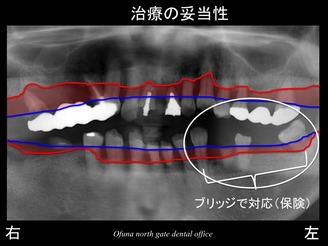 饤18