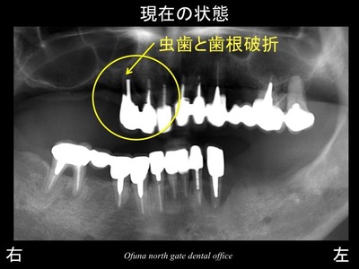 饤09