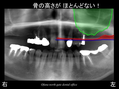 饤07