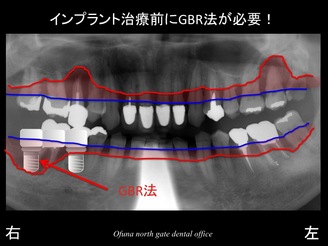 饤09