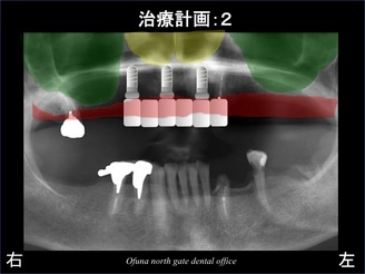 饤08