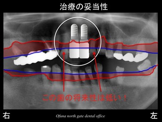 饤12