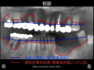 饤02