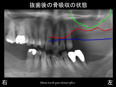 饤12