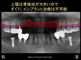 饤28