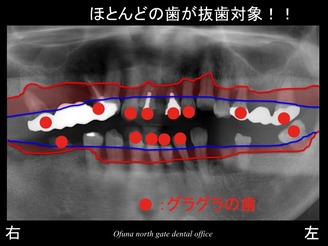 饤06