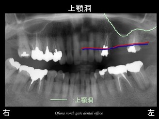 饤17