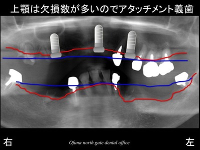 饤13