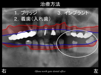 饤19