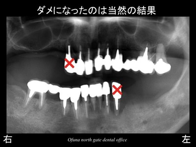 饤15