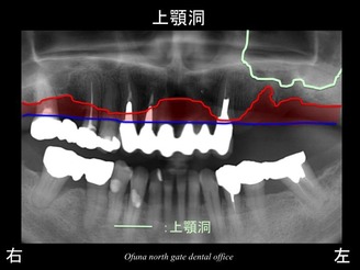 饤22