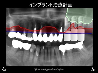 饤26