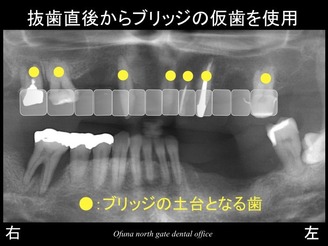 饤14