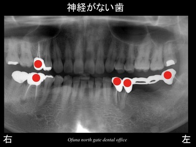 饤06