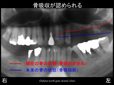 饤2