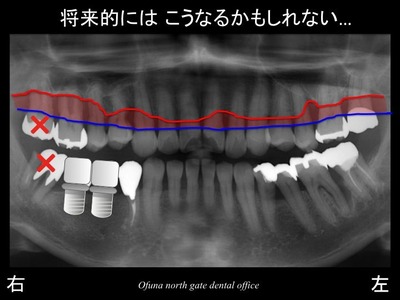 饤23