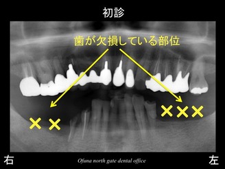 饤02