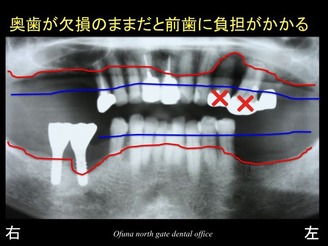 饤12